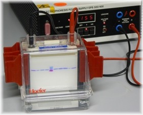 Polyacrylamide_electrophoresis