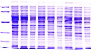 Protein_gel